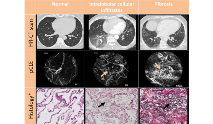 Images Histo-CLE-CT.png